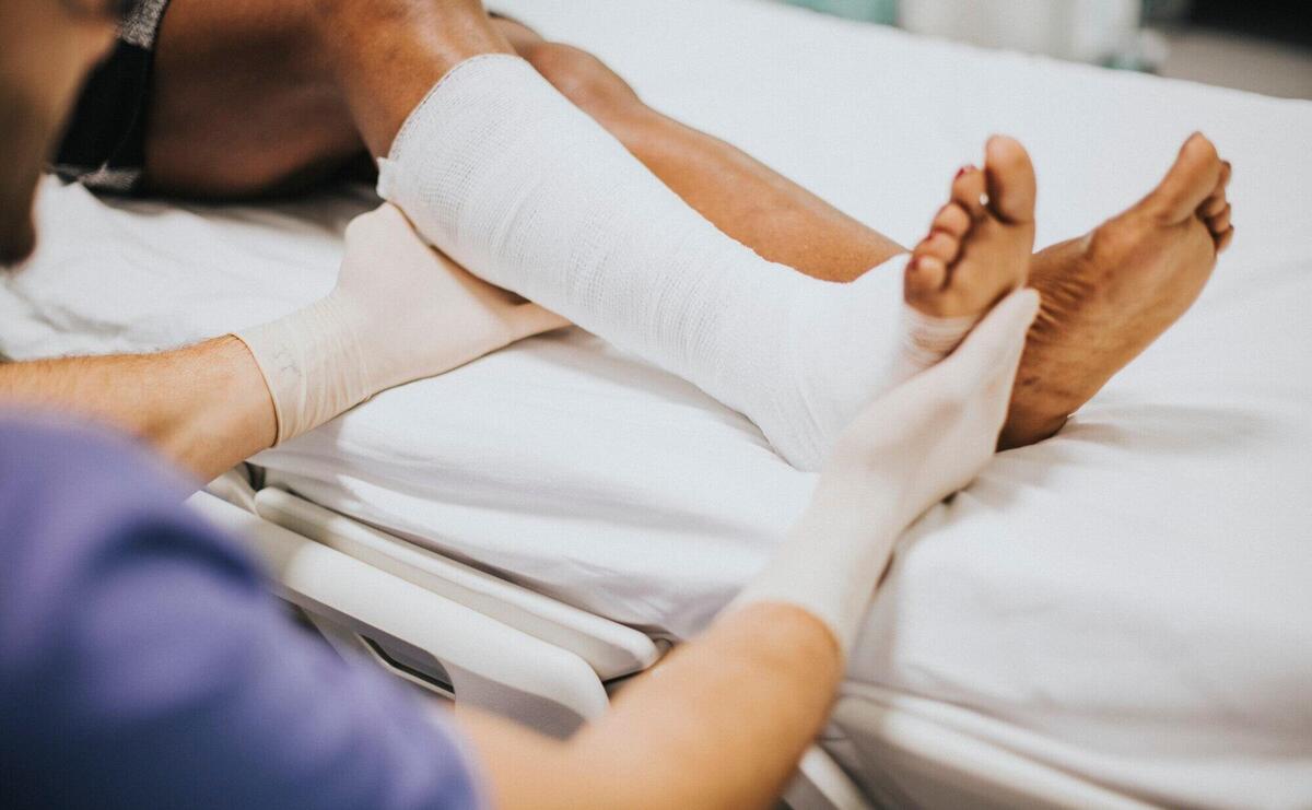 Doctor helping a patient with a fractured leg